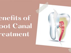 Benefits of Root Canal Treatment