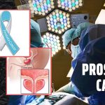 Prostate Cancer: Causes, Symptoms, Treatment, and Prevention