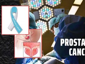 Prostate Cancer: Causes, Symptoms, Treatment, and Prevention