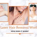 Laser Hair Removal Works – How Does It Work?