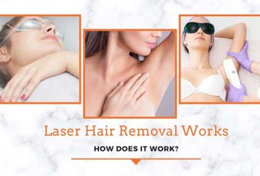 Laser Hair Removal Works – How Does It Work?