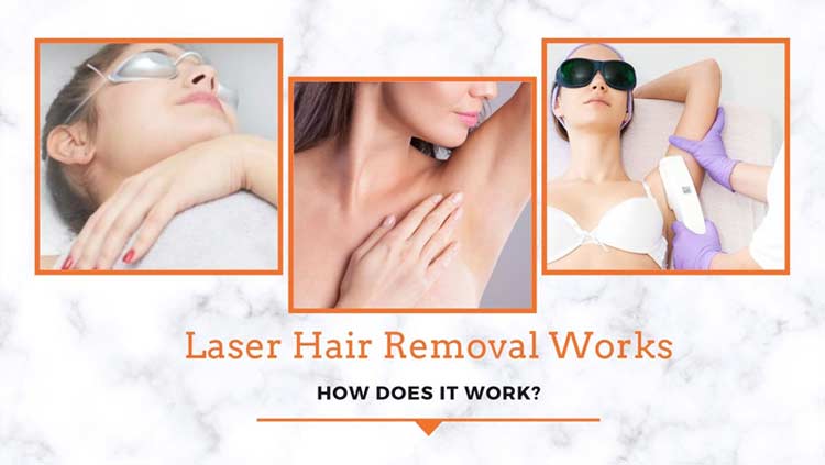 Laser Hair Removal Works – How Does It Work?