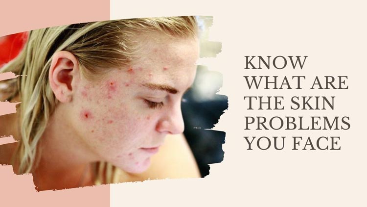 Know What Are The Skin Problems You Face