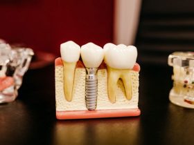 How to Choose an Orthodontist for My Braces?