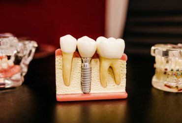 How to Choose an Orthodontist for My Braces?