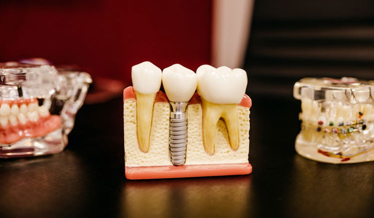 How to Choose an Orthodontist for My Braces?