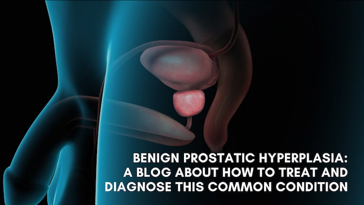 Benign prostatic hyperplasia: A blog about how to treat and diagnose this common condition
