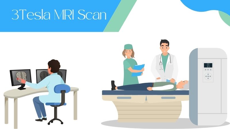 What is 3 Tesla MRI: Procedure, Benefits and Price