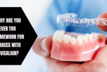 Why Are You Never Too Timeworn For Braces With Invisalign?