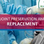 Understanding Joint Preservation & Joint Replacement