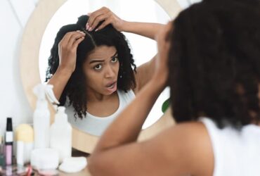 Should Wear a Wig If Have Dandruff