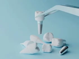 Dental Implants - A Path To Better Health