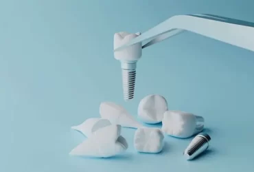 Dental Implants - A Path To Better Health
