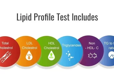 Lipid Profile Test