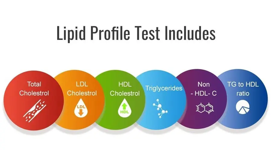 Lipid Profile Test