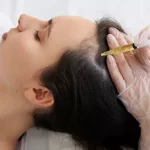 Hair Transplant in Pune