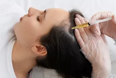 Hair Transplant in Pune