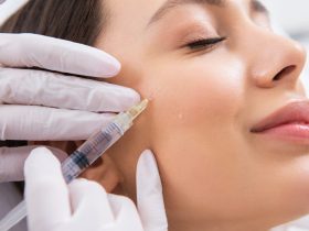 Facial Contouring Made Simple with Cheek Fillers